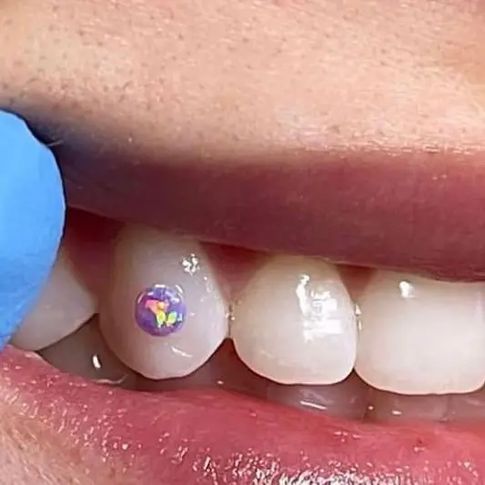 wholesale 18k gold tooth gems crystals lead free glue dental kit tooth gem opal