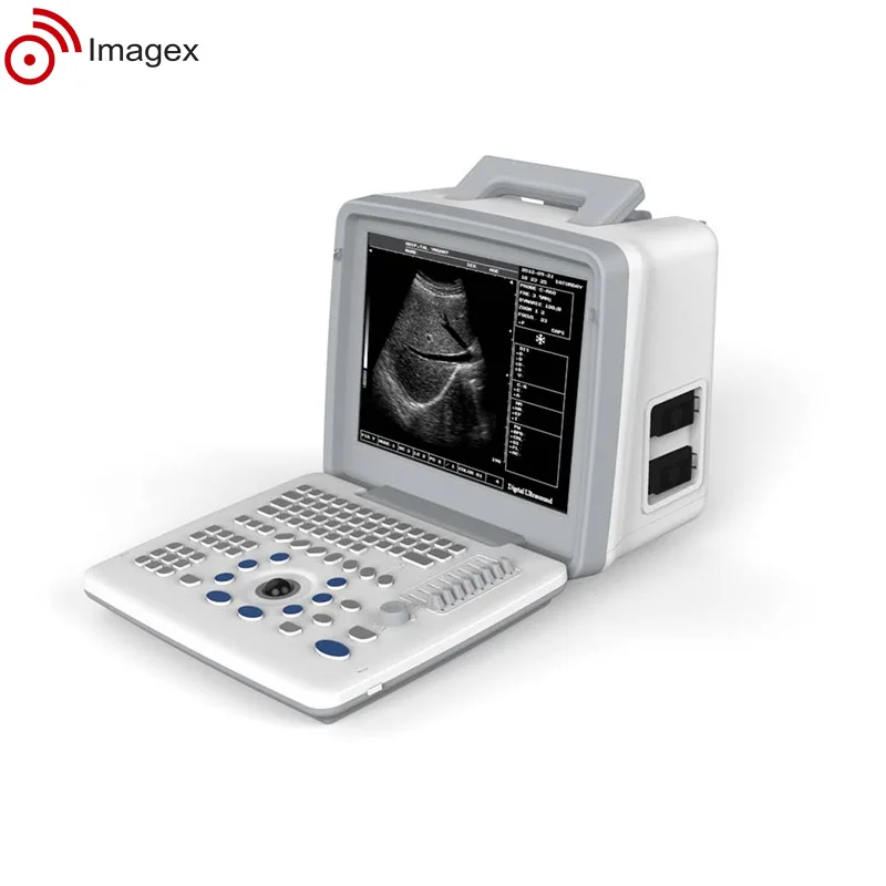 Портативный ультразвуковой аппарат с многочастотными зондами для акушерства и гинекологии