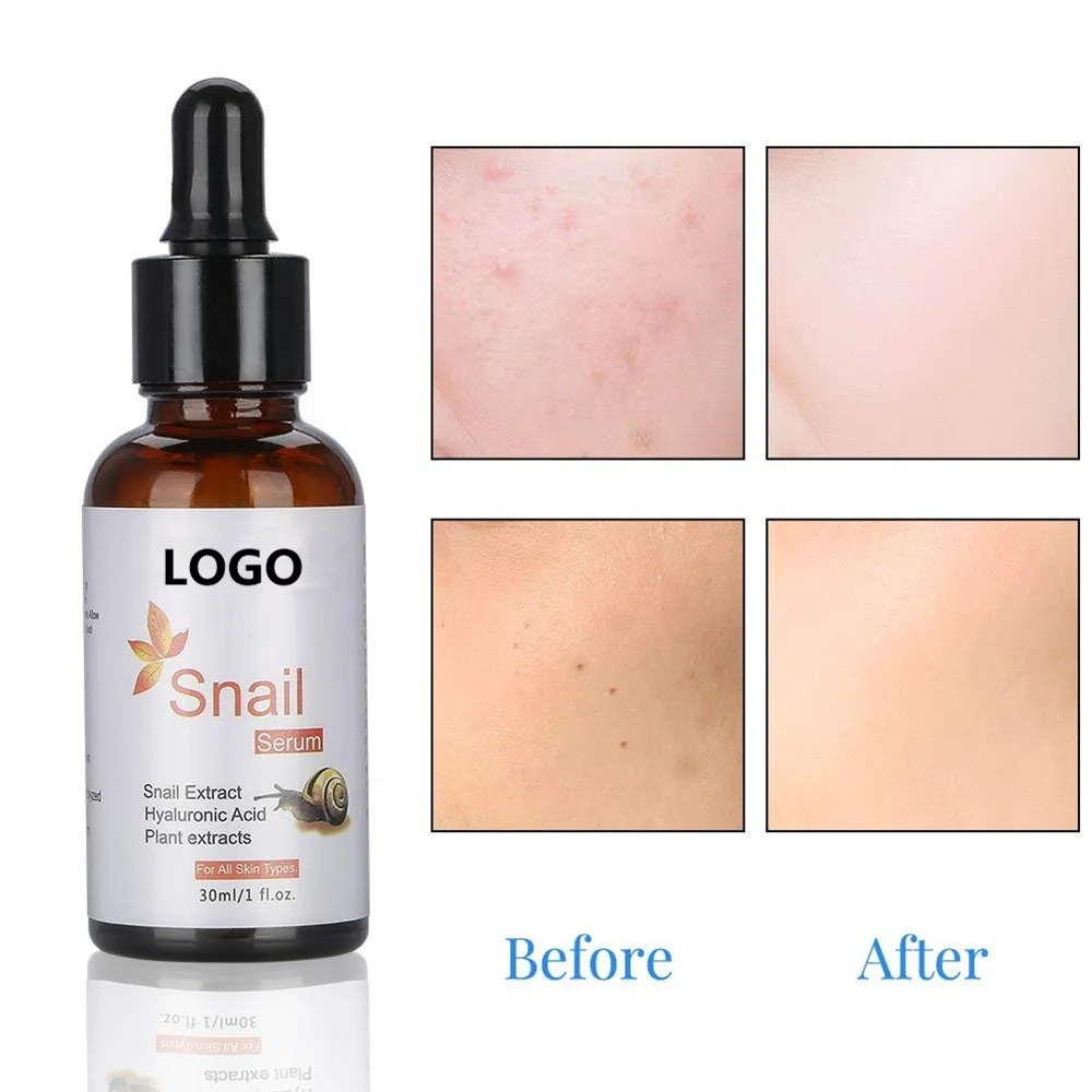 Private Label OEM 100% Natural Green Tea Beauty Snail Repair Brightening Face Skin Care Serum