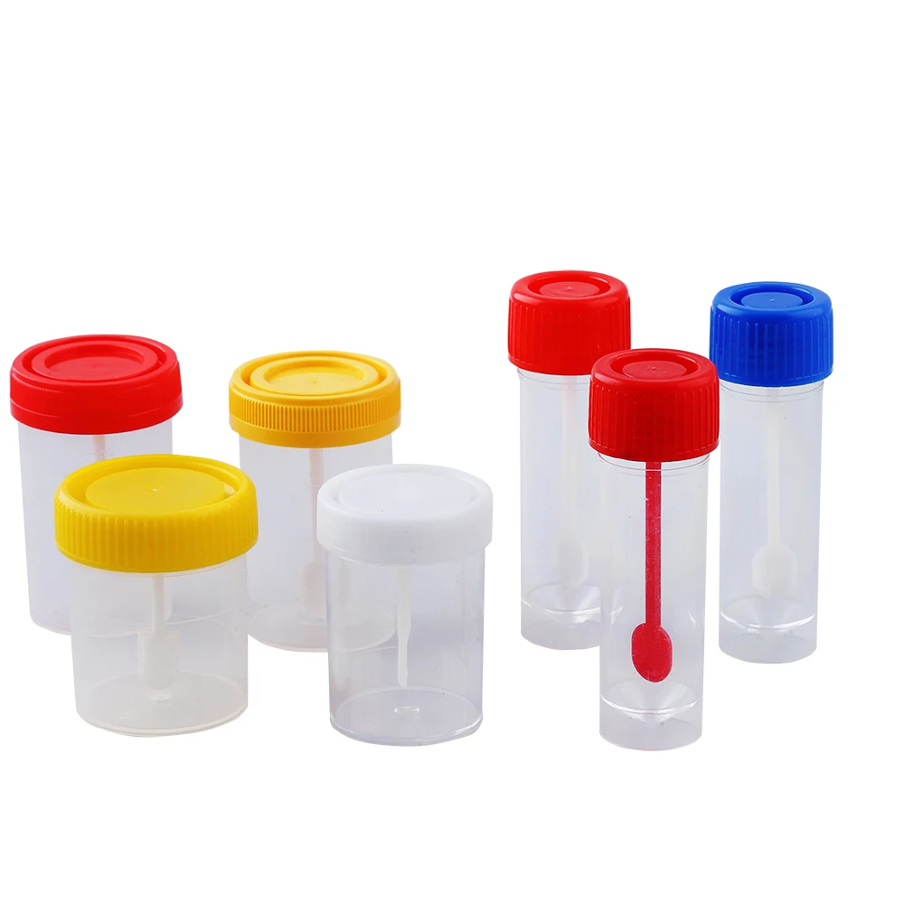 Factory Direct Laboratory Plastic Disposable Urine Sputum Specimen Container