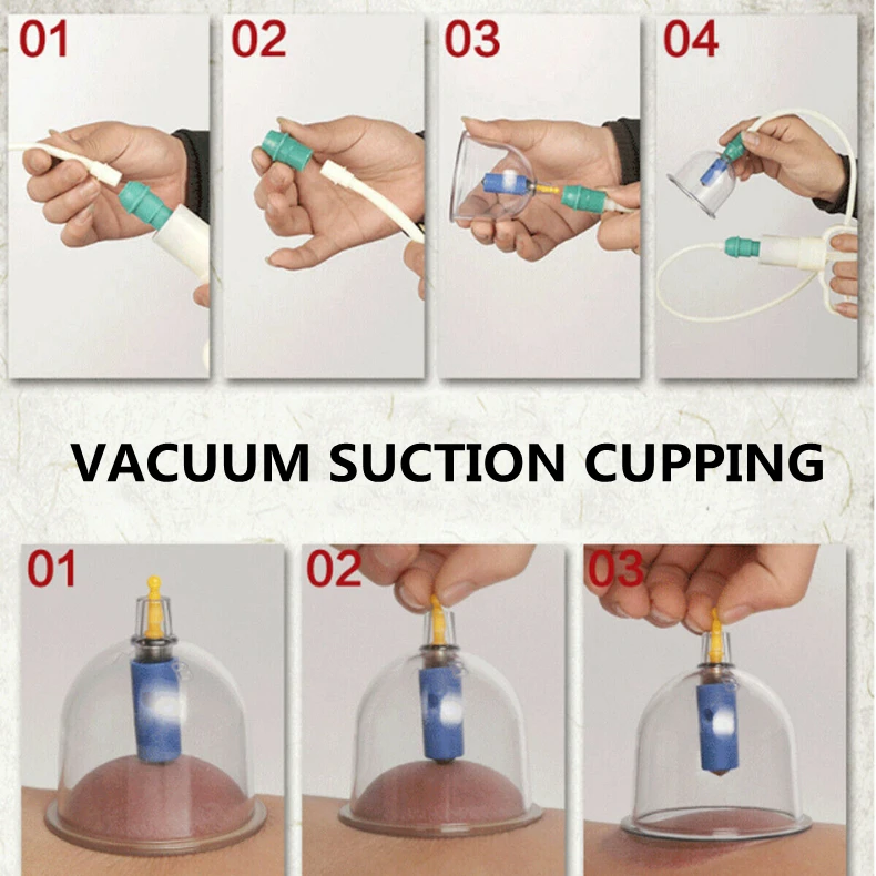 Китайская медицинская Вакуумная чашка Hijama Набор чашек для терапии пластиковые