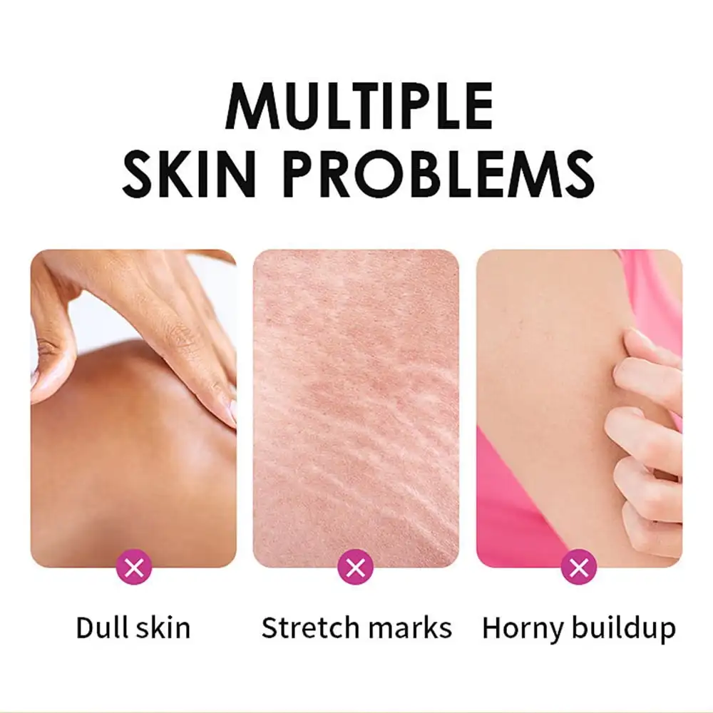 Private Label Extra Strength Yellow Peeling Oil Original Remove Dead Skin Exfoliating Gallon Peeling Oil
