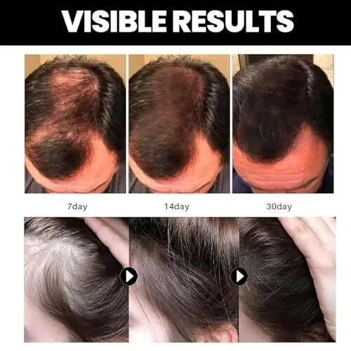 Rosemary Scalp Hair Strengthening Oil 15ml Organic Natural Rosemary Essential Oil Rosemary Oil Hair Growth