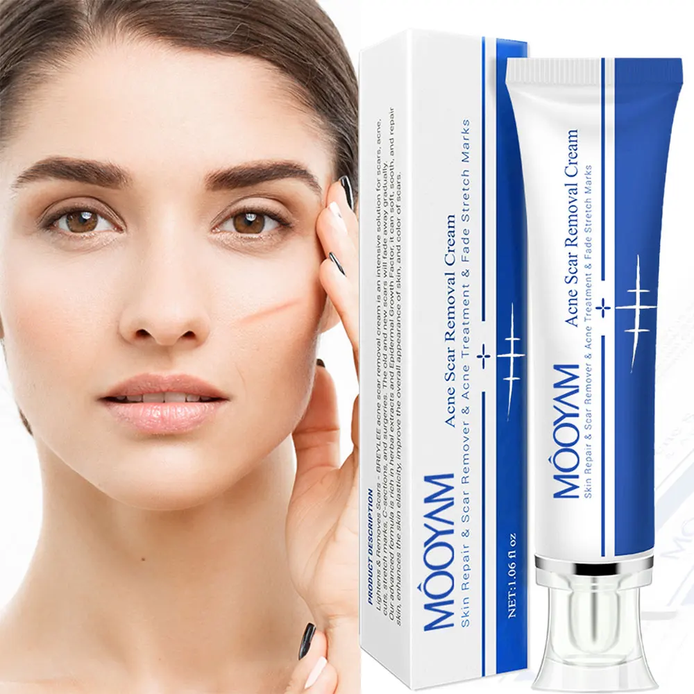 Strong Effective Acne Scar Removal Cream Pimples oem Face Gel Tummy Tuck Tightening Stretch Mark Removal Cream