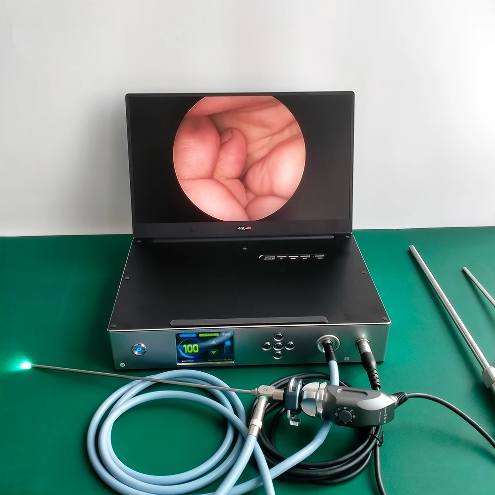 Medical ENT full HD Endoscopy Unit Portable Endoscopic laparoscopic camera