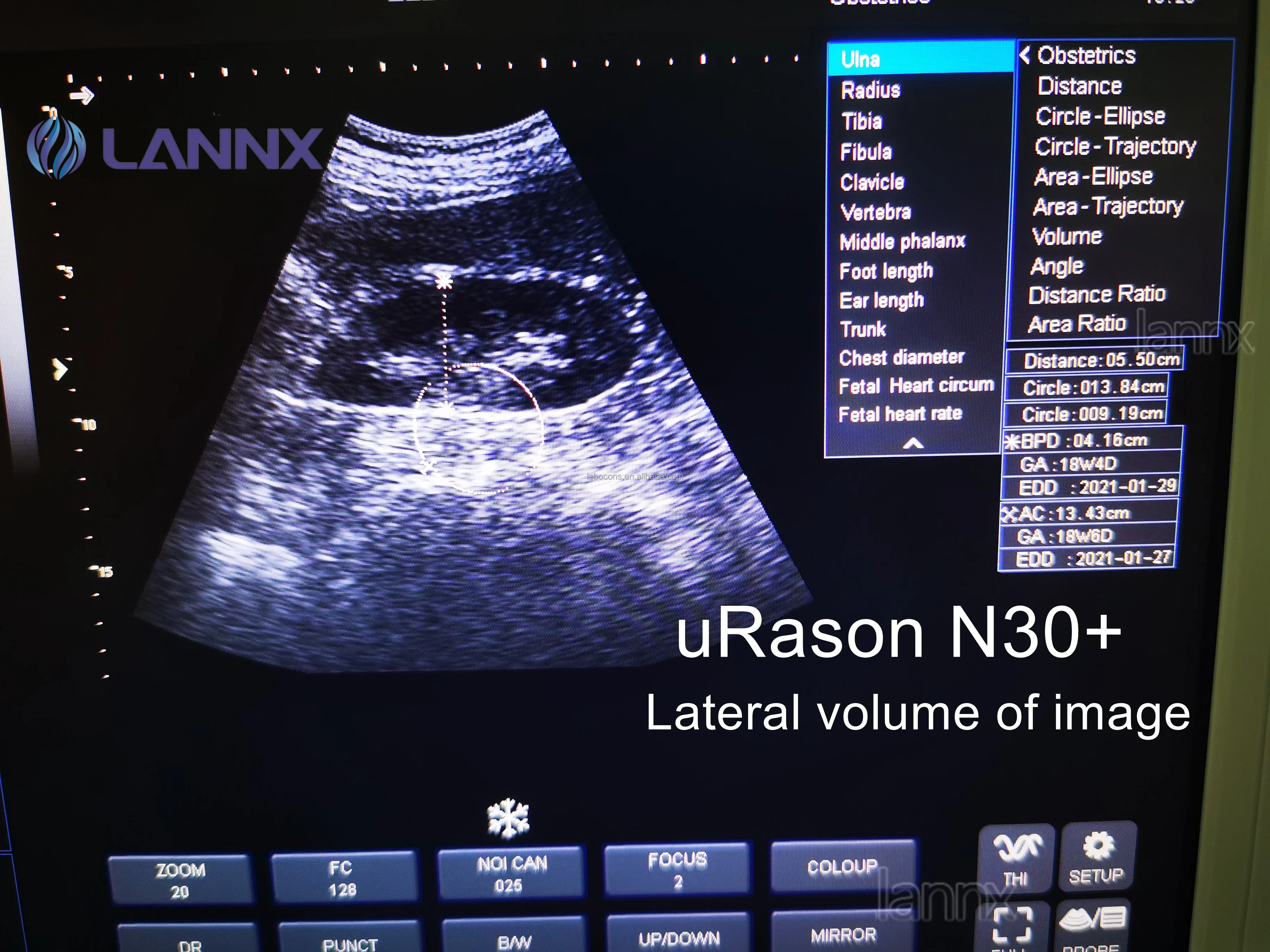 LANNX uRason N30+ Lower price Pregnancy Examination PW B/W Ultrasound Device ultrasonic Scanner Laptop Ultrasound Machine