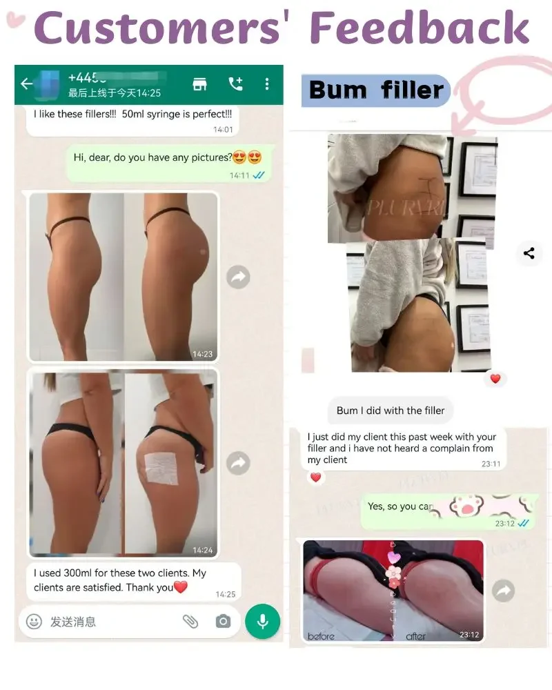 Fast shipments Subskin 10ml  Hyaluronic Acid Injection Dermal Filler Hyaluronate Gel Injections Buttock Breast Dermal Filler