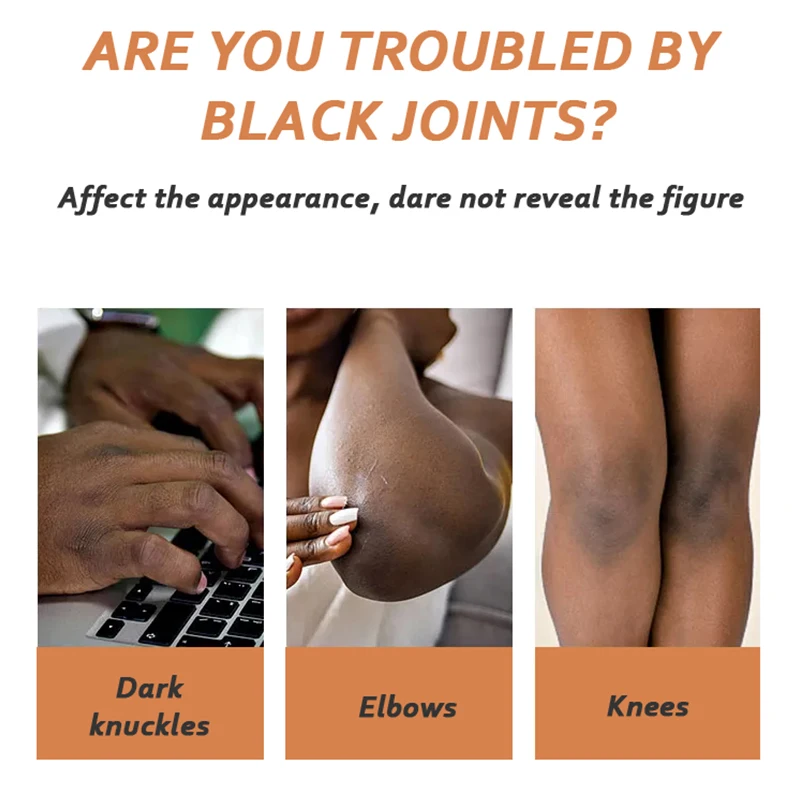 5D gluta Dark Knees and Elbows Strong Underarm Whitening Cream Armpit Fast Action Extreme Whitening Cream