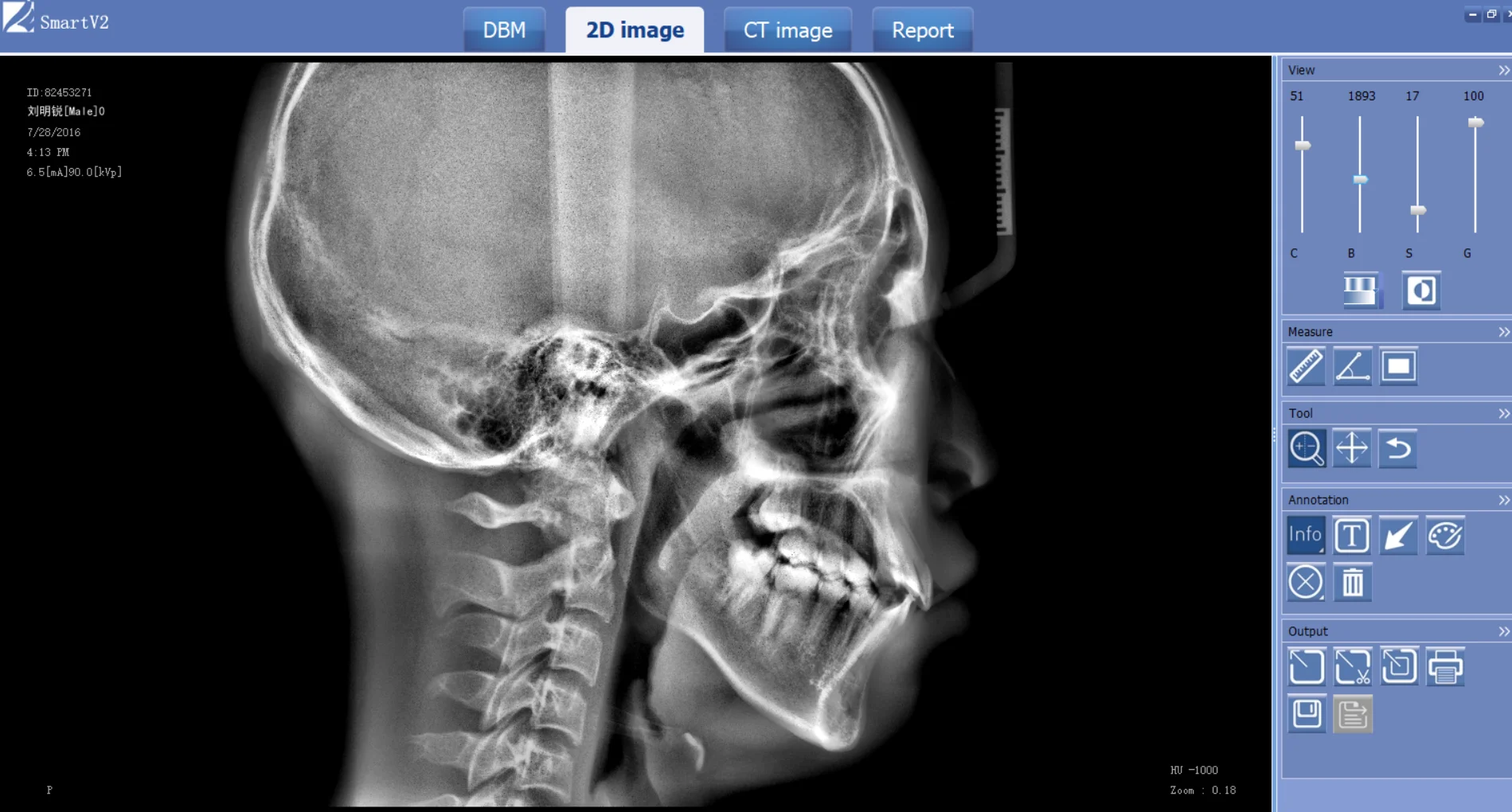 
Professional best selling Cone beam CT multifunctional dental CBCT Radiology Equipment 