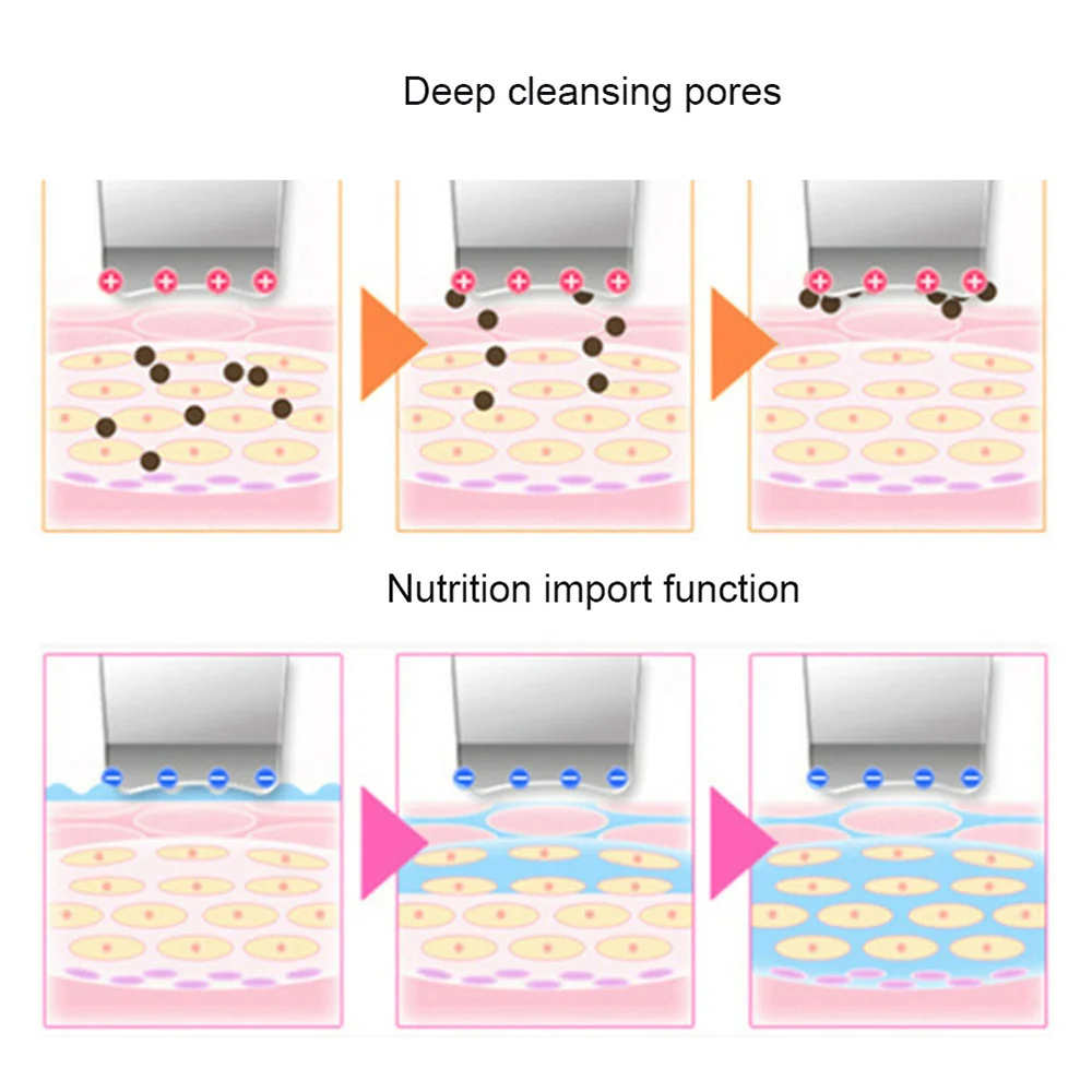 2022 Electric facial dead skin peeling professional sonic cleaning ultrasonic skin scrubber blackhead remover face spatula