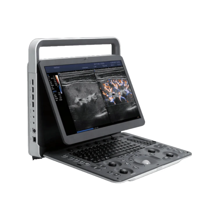 Medical Ultrasound Instruments Sonoscape E2 ultrasound With Competitive Price