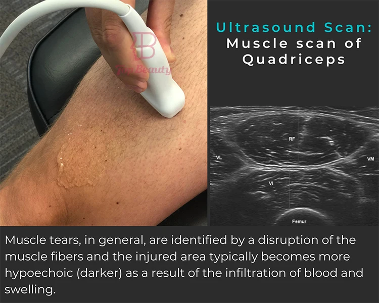 Portable Site-rite Ultrasound Scan 3D 4D Full Digital Medical Ultrasonido Portatil Hospital Diagnostic Laptop Machine