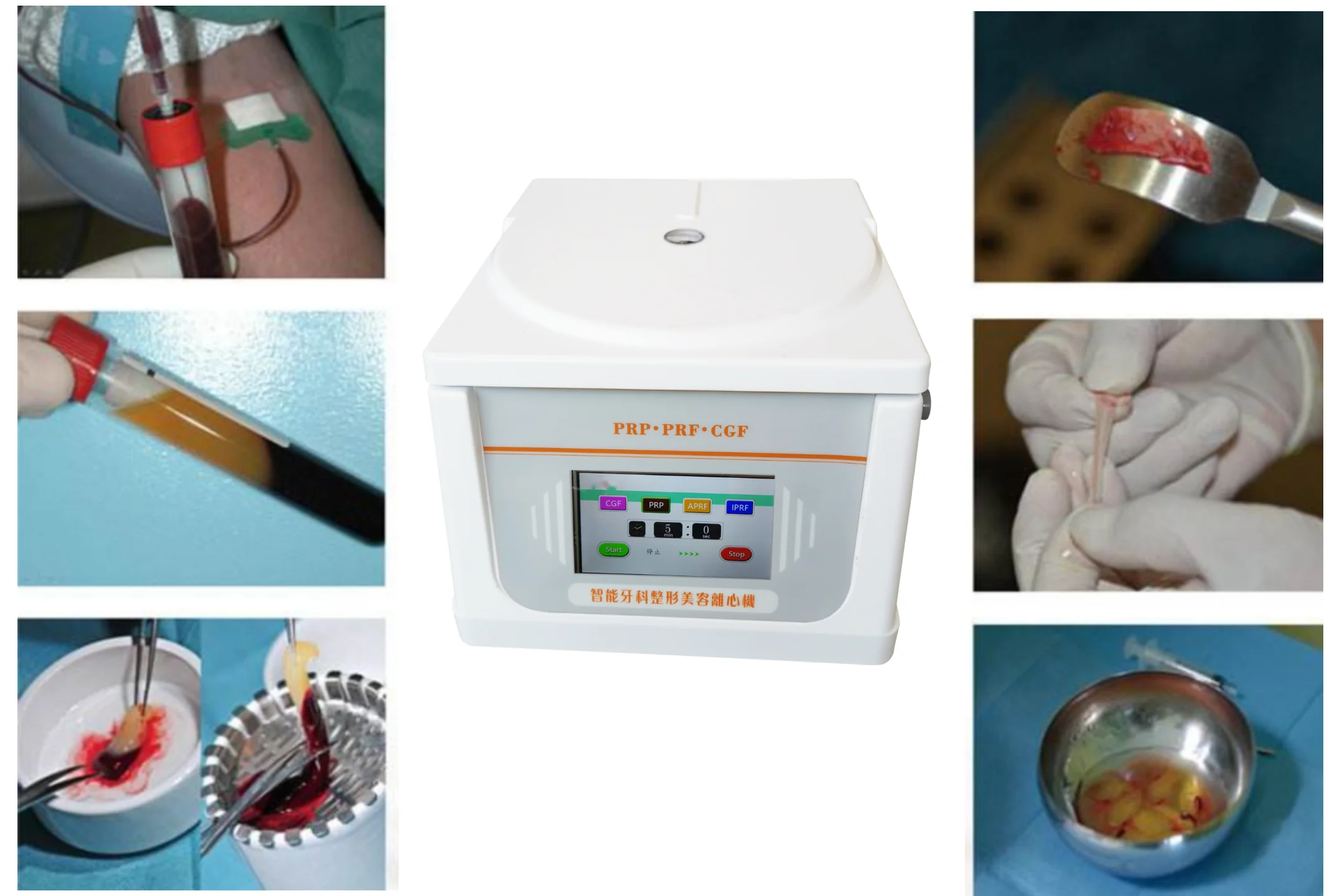 Smart Size Mini Type Low Noise Light Weight Dental PRF CGF Centrifuge TD4A