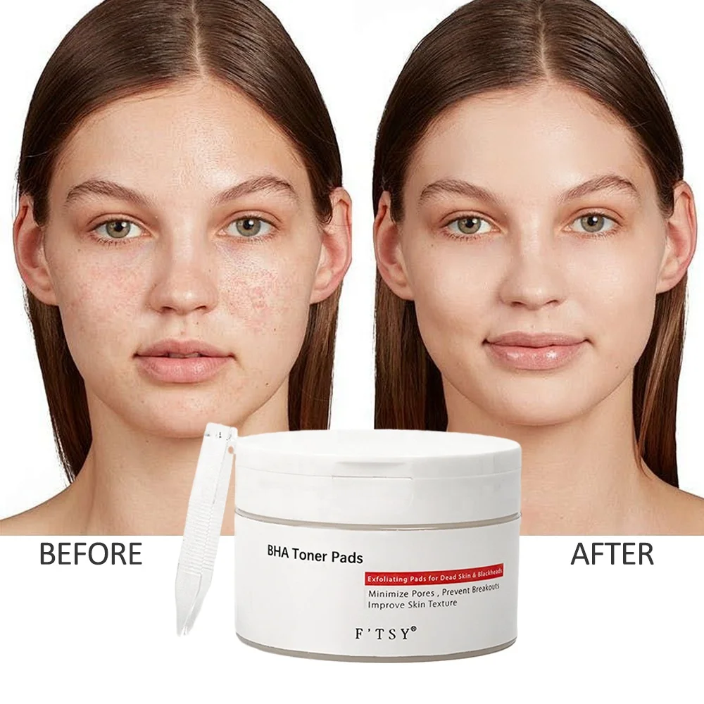 Custom BHA Toner Pads Exfoliating Pores Cleansing Anti Acne Cotton Pads Gentle Remove Dead Skin Pads