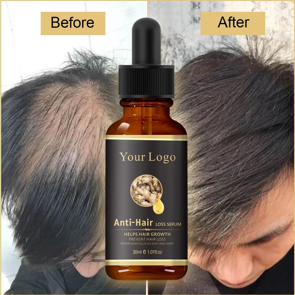 OEM Natural Organic Ginger Oil Hair Growth Treatment Anti Loss Hair Growth Serum for anti hair fall