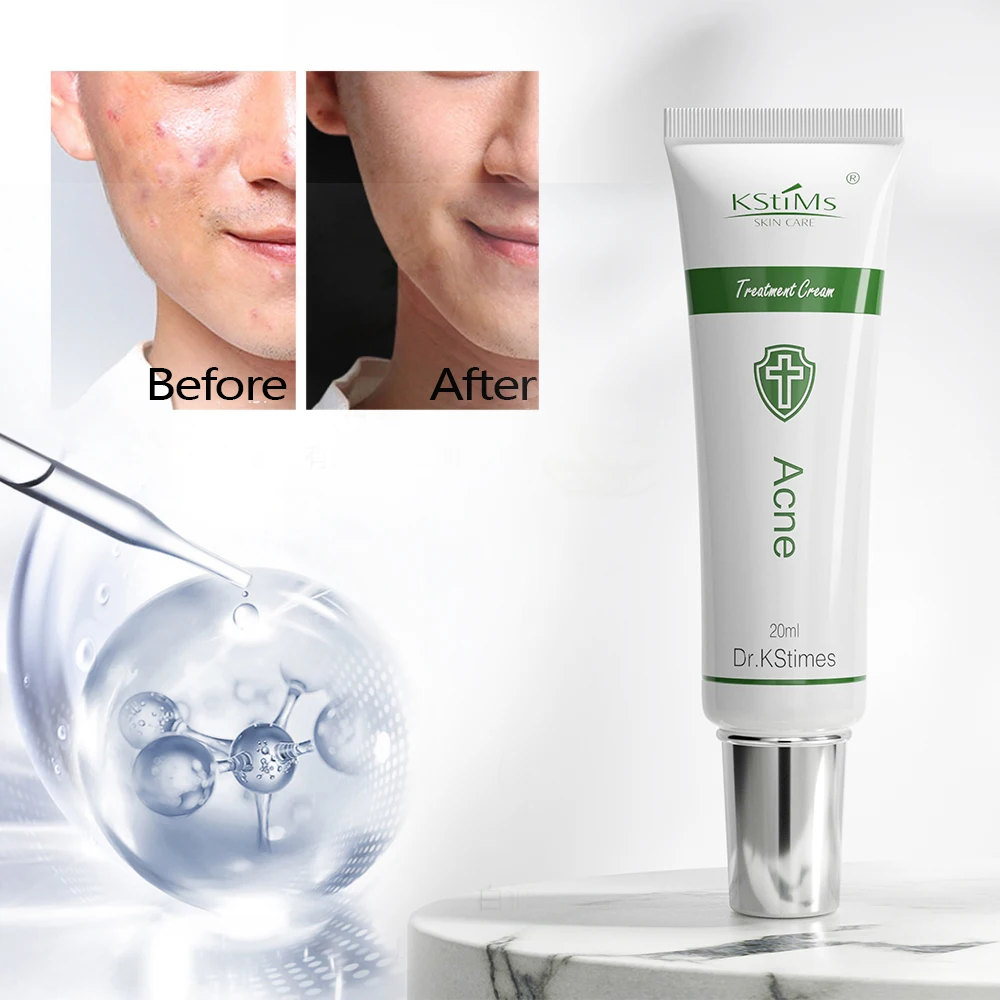 Chinese Herbal Tea Tree Oil Rose Face Cream for Acne Treatment Private Label Pimple Remover Gel