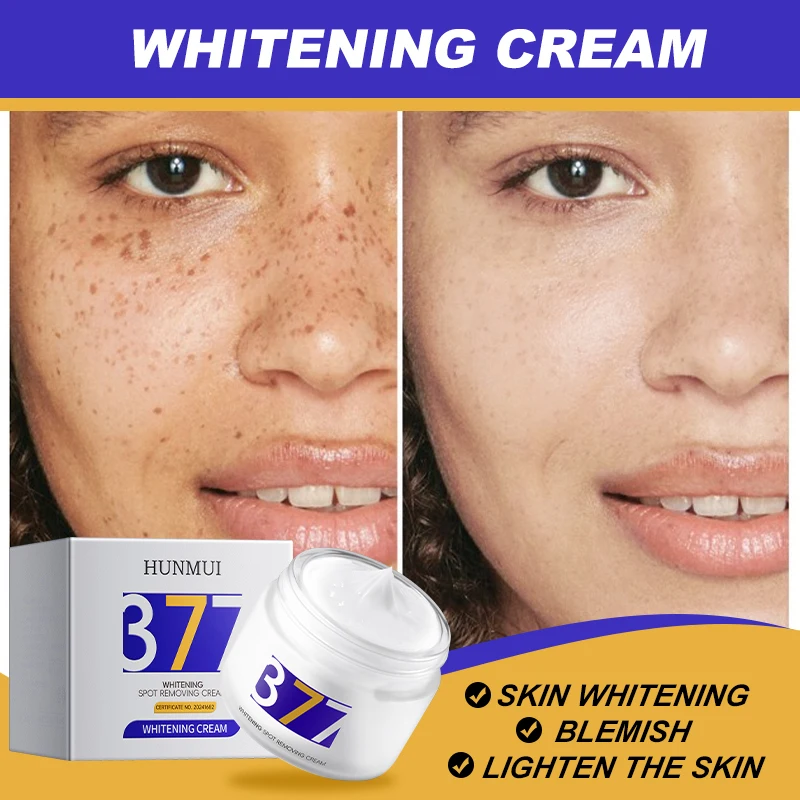 customized morning and evening cream whitening, fading, spot protection, color control, spot removal cream
