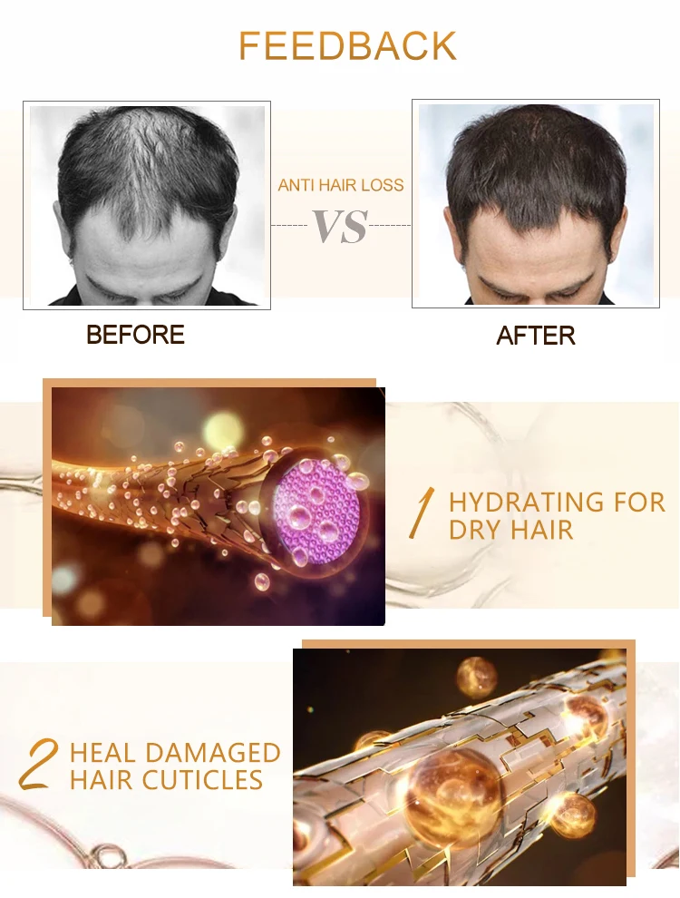 
Private Label 3+ Mint Clean lnvigorating Anti Dandruff Hair Anti-loss Growth Shampoo And Conditioner Set For Thinning Hair 