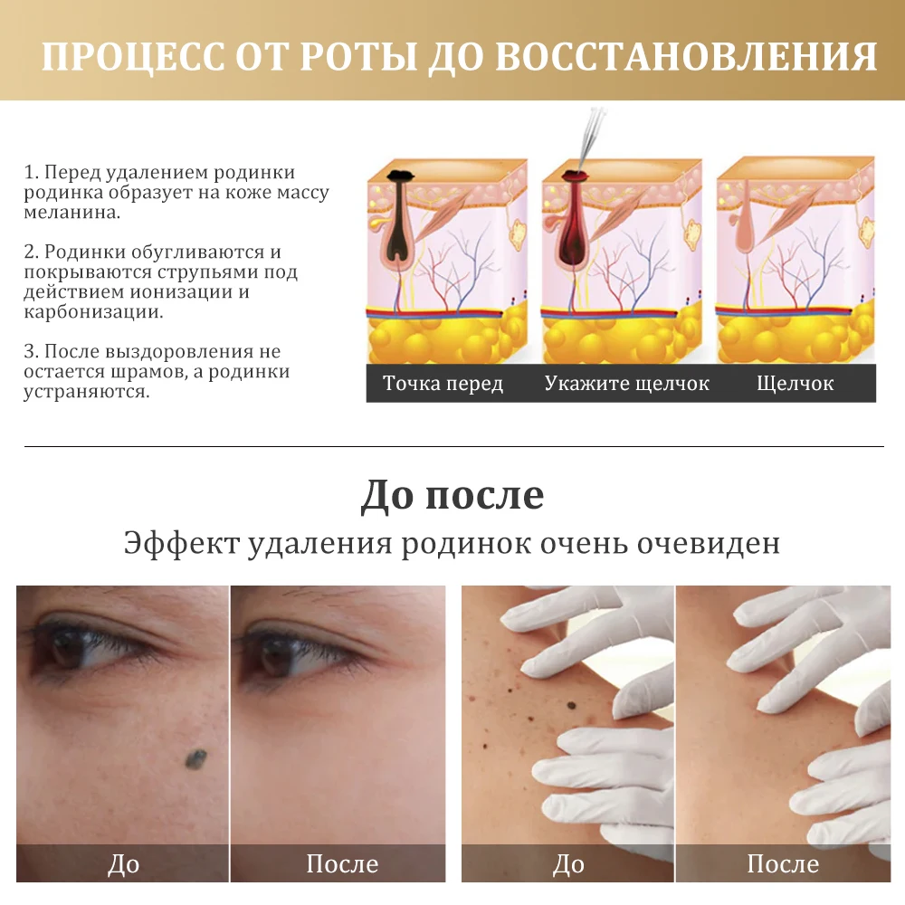 Russia Support Rubles Payment Multifunctional Plasma Pen Mole Spot Skin Tag Remover Freckle Removal Ozone Fibroblast Plasma Pen