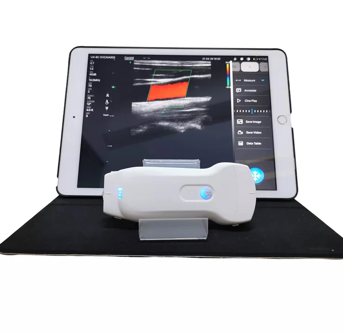 MC27 Most welcomed portable wifi wireless color doppler ultrasound ecografo probe with convex, cardiac and linear functions