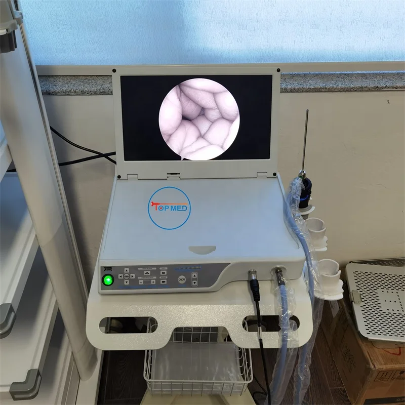 FHD Endoscopy Camera HD Unit Portable endoscope camera system for Laparoscopy Hysteroscopy Urology ENT Arthroscopy
