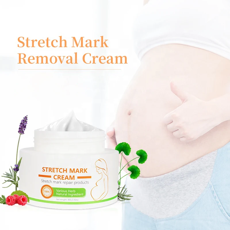 OEM Wholesale Private Label Best Natural Mango Pregnancy Scar Stretch Mark Removal Cream