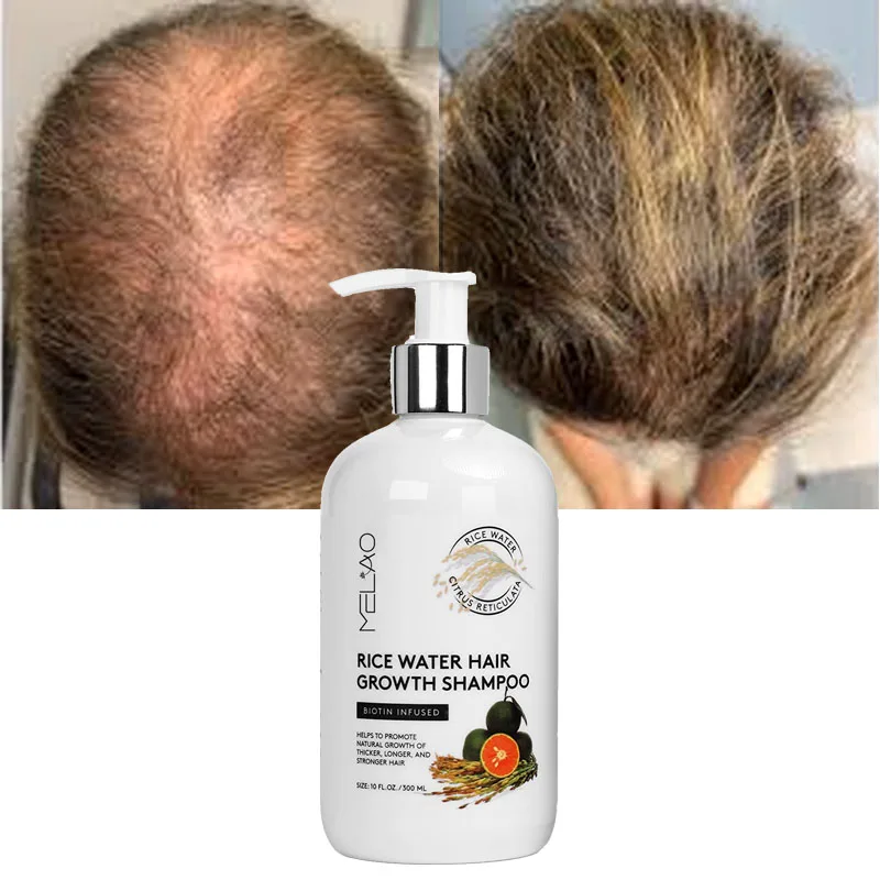 Vegan Hair Thickening Moisturizing Anti-Hair Loss Rice Shampoo Rice Water Hair Growth Shampoo