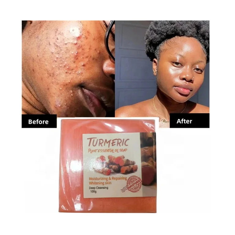 Custom organic ginger handmade tumeric bar soap bath anti acne dark spots removal whitening turmeric soap