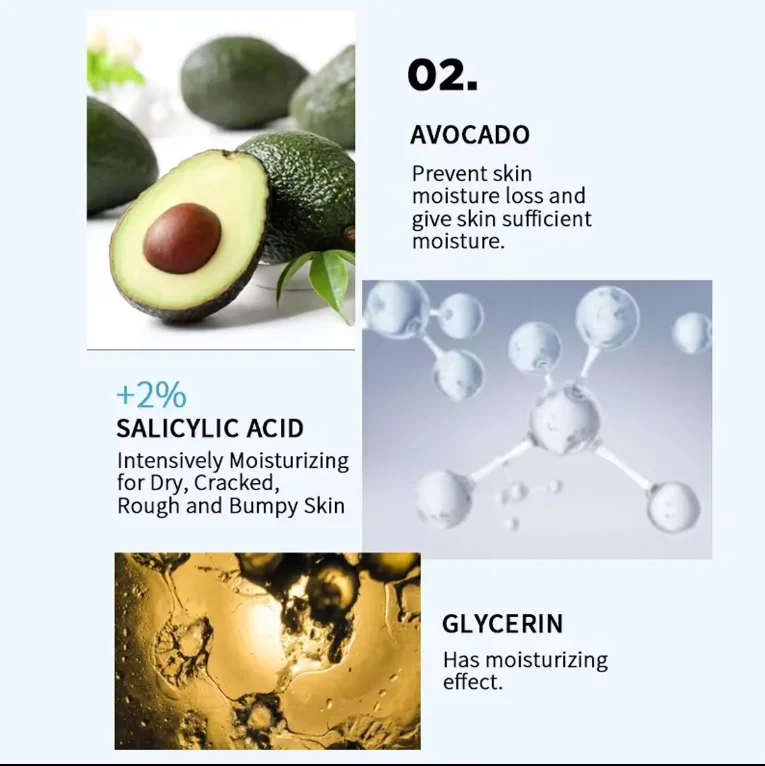 2% salicylic Acid Dead skin removal exfoliating treatment for cracked heels urea 40% foot cream hand and foot cream