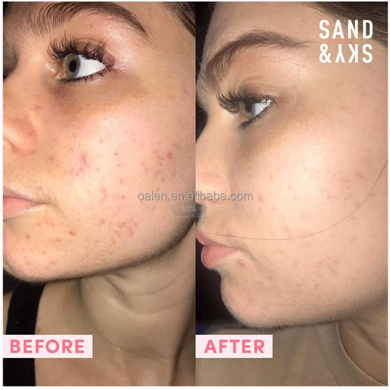 Best Oil Control Purifying Clay Mask Skin Detoxifying Charcoal Face Stick Mask