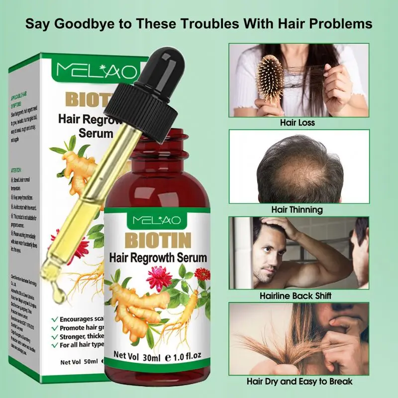 Discount now Wholesale Best 100% Pure Therapeutic Body Massage Skin Moisturizing Nourishing Anti-Acne Ginger Oil For Hair Growth