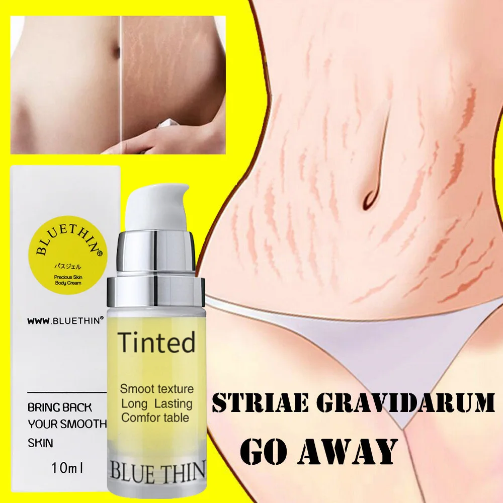 Postpartum Body Fading Stretch Marks Repair Obesity Removal