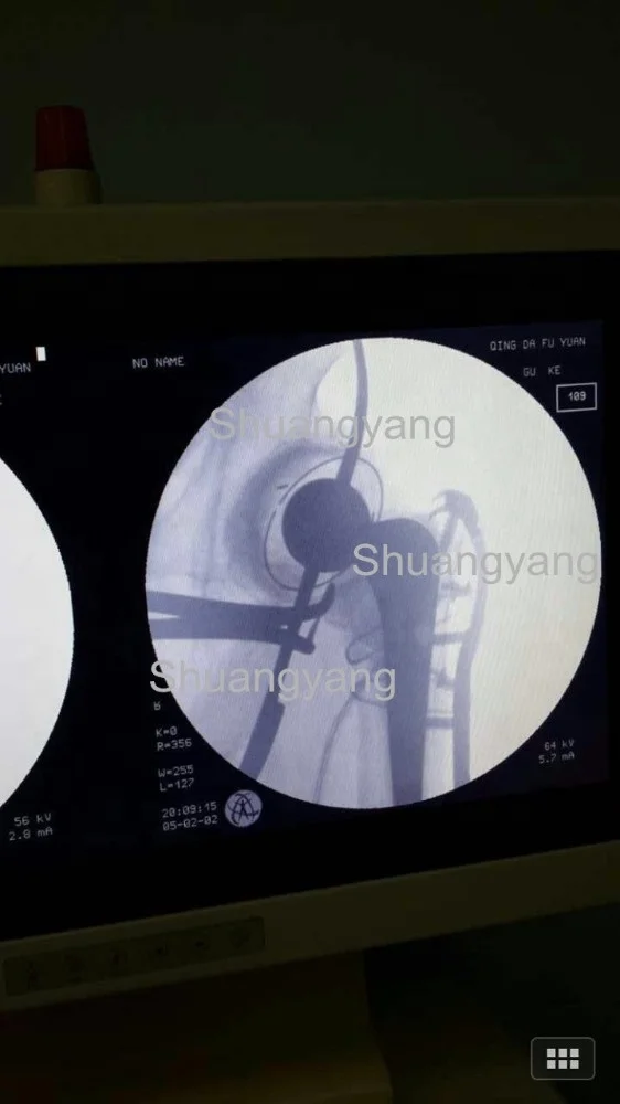Titanium cable and locking plate Implant for Orthopedic femur fractures (Cerclage Wire)