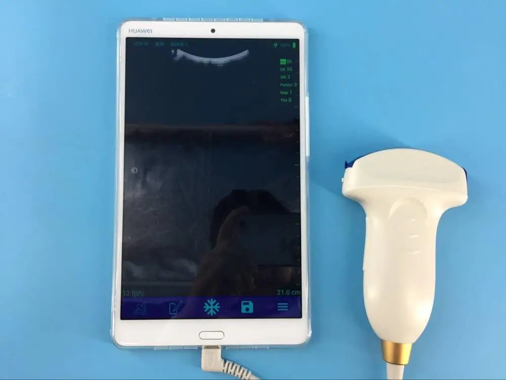 SUN-P1 ultrasound machine display USB convex probe smart phone computer convex probe price