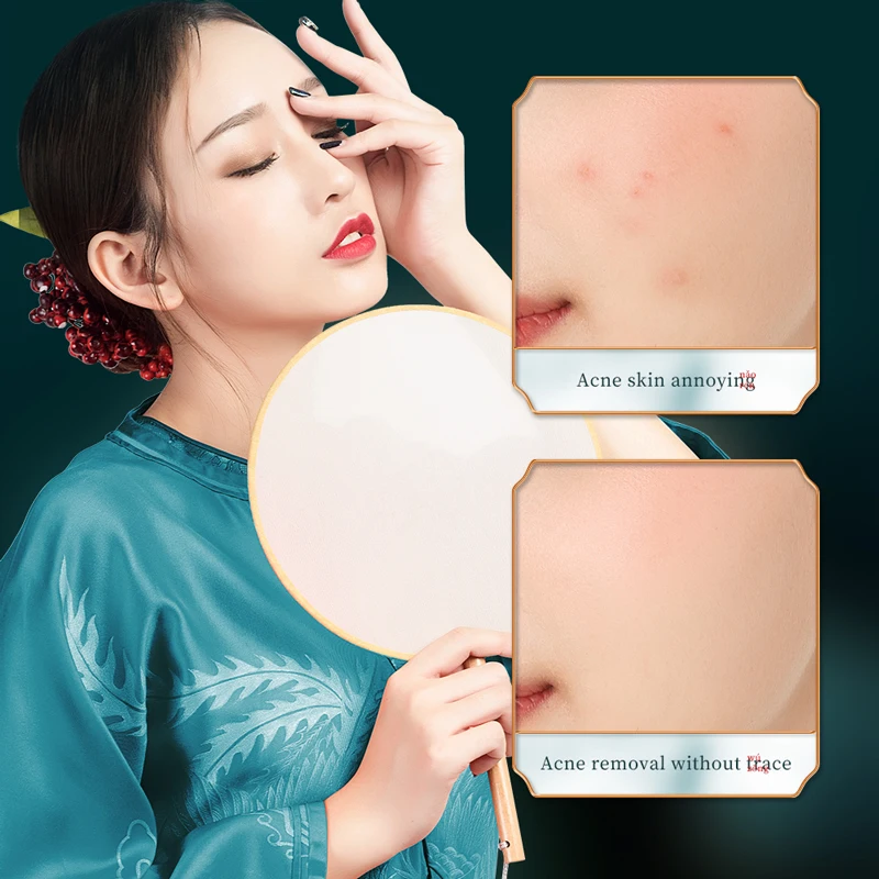 Private Label BAIZTON Herbal Plant Extract Anti-Acne Skin Care Set Facial Serum Face Cream Hydrating Skin Care Kit