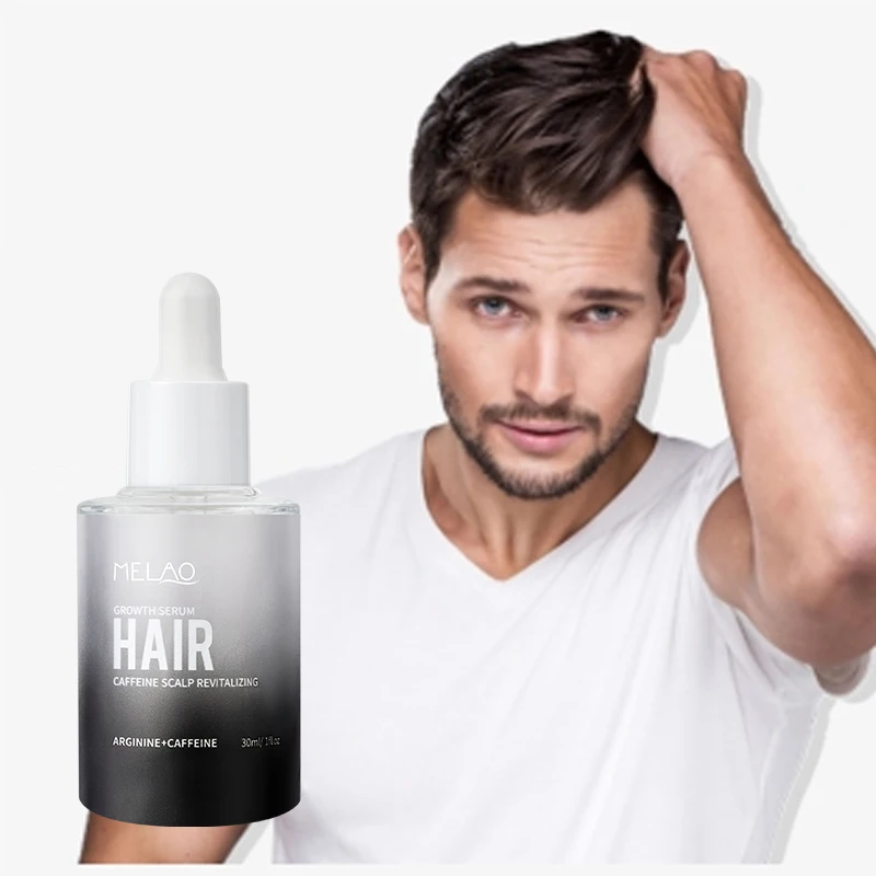 Custom Logohair Loss Treatment Scalp Serum Regrowth Anti Hair Fall Ginger Oil For Hair Growth Men