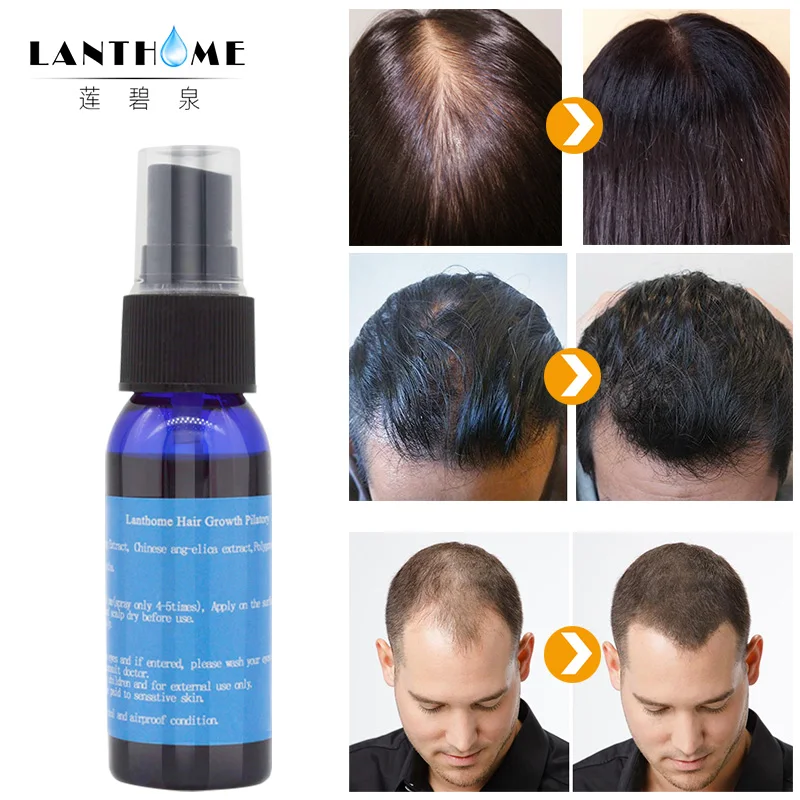 system jamaican black castor oil faster hair growth products  shampoo cream