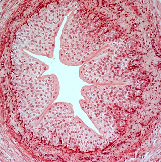 BestScope BUC1D-210C 2.1MP Standard C-mount USB2.0 Color CMOS Sensor Digital Microscope Camera