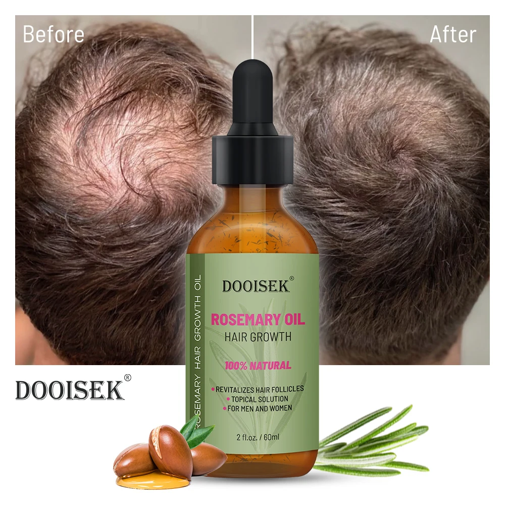 Private Label Natural Rosemary Nourishing Serum Anti Hair Loss Care Treatment Products for Strengthening Scalp Fast Growth Oil