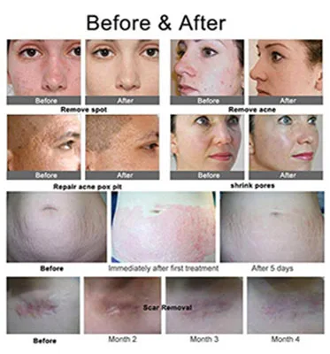 YanYi Anti Aging Dr pen M8 Ultima Derma Pen