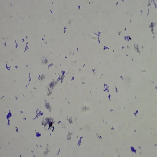 Medical Microbiology Slides Microscope Slides 100pcs Educational Prepared Slides Medical Microbiology Education