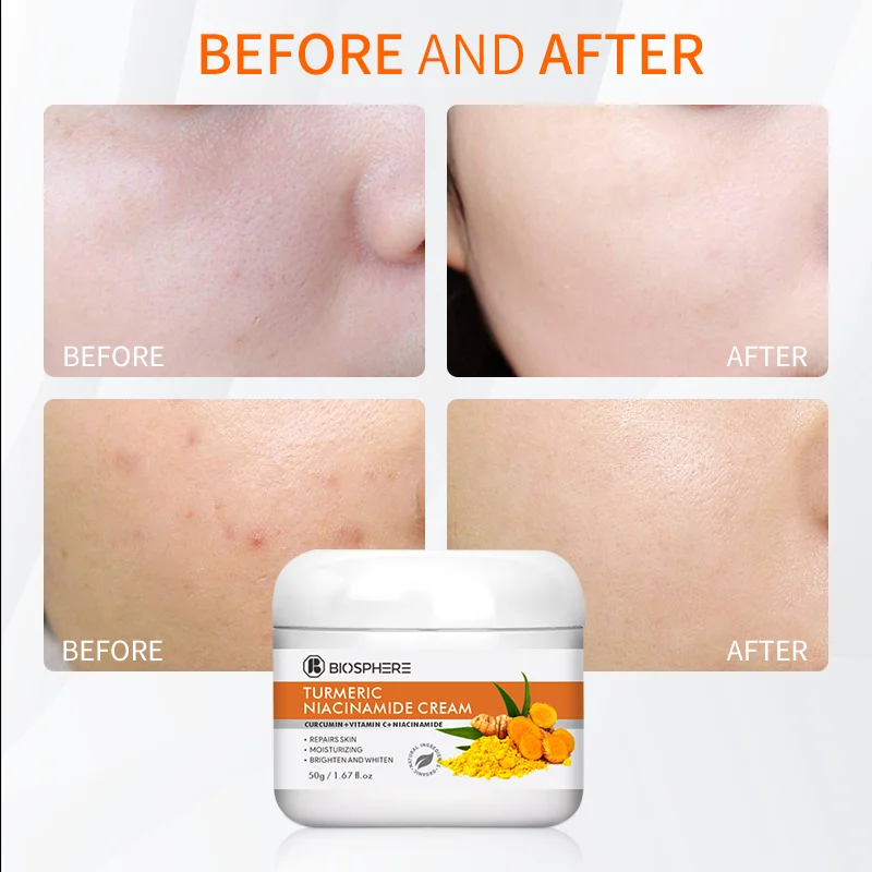 Paraben Free Private Label Japanese Skin Whitening Cream Facial Moisturizer Organic Whiting Cream For Face And Body