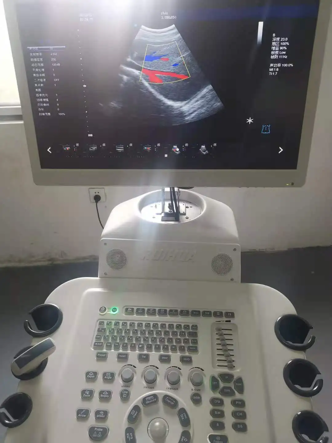 Ruihua brand  3d/4d CW Color Doppler Ultrasound echo machine convex linear
