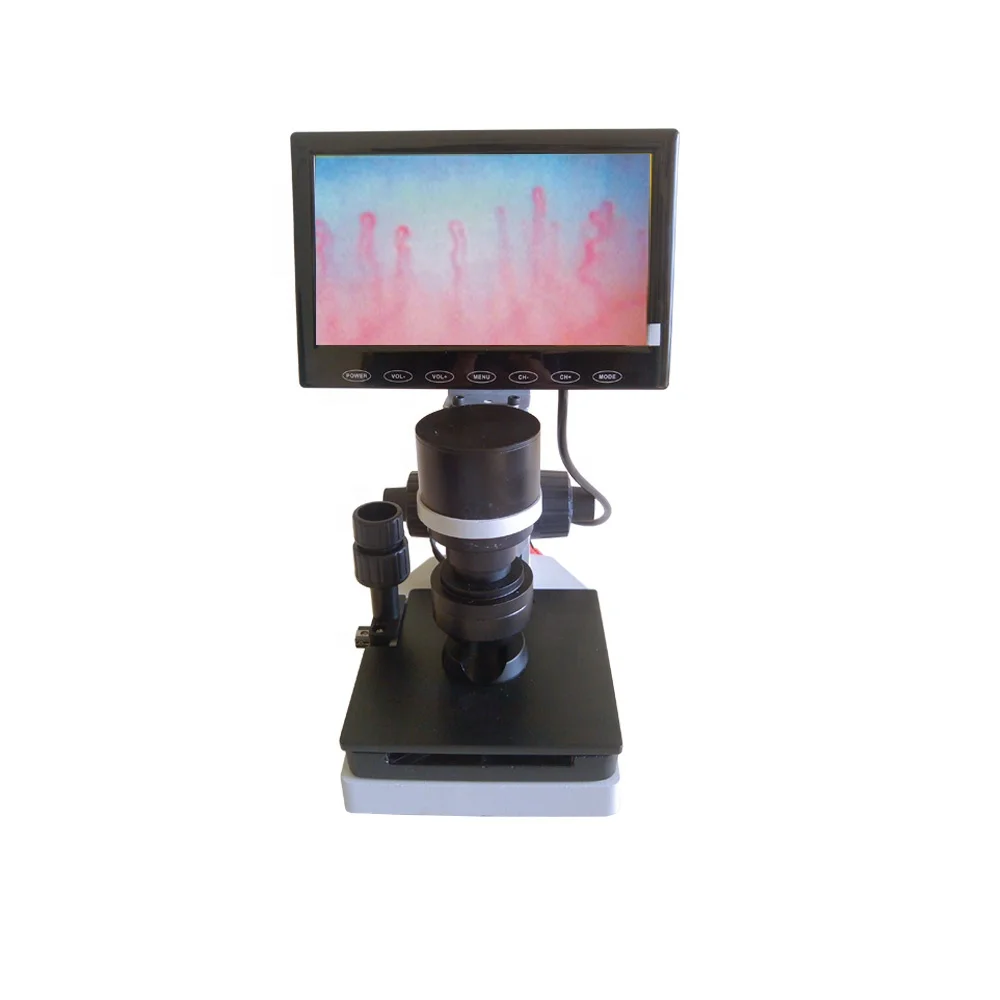 Nailfold capillary LCD Digital Microcirculation Microscope for health analyzsis
