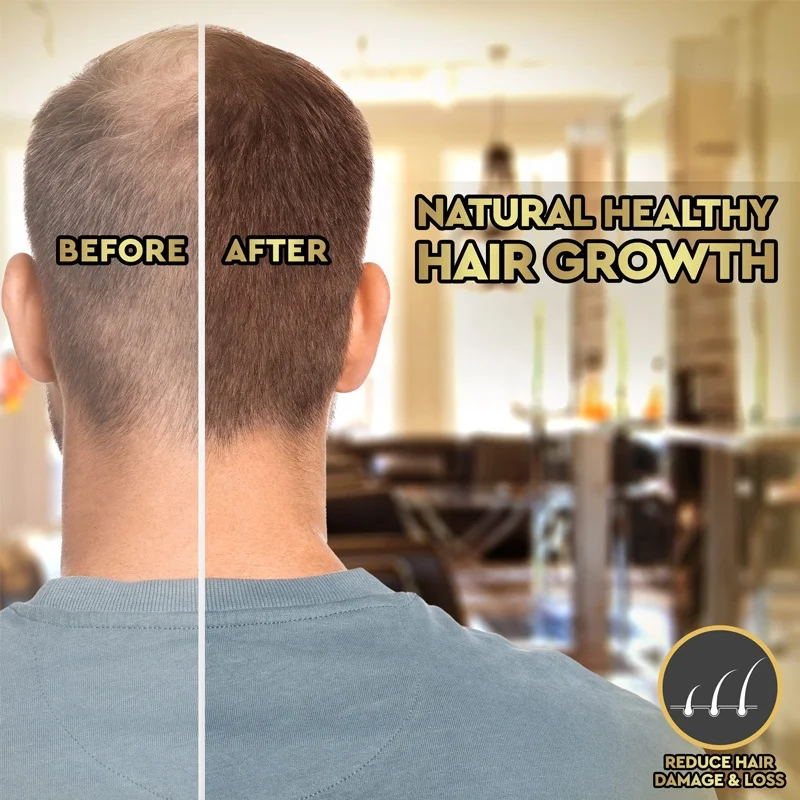 Роскошный медный пептид Ghk-cu с логотипом на заказ предотвращающее выпадение волос масло для роста мужчин и женщин