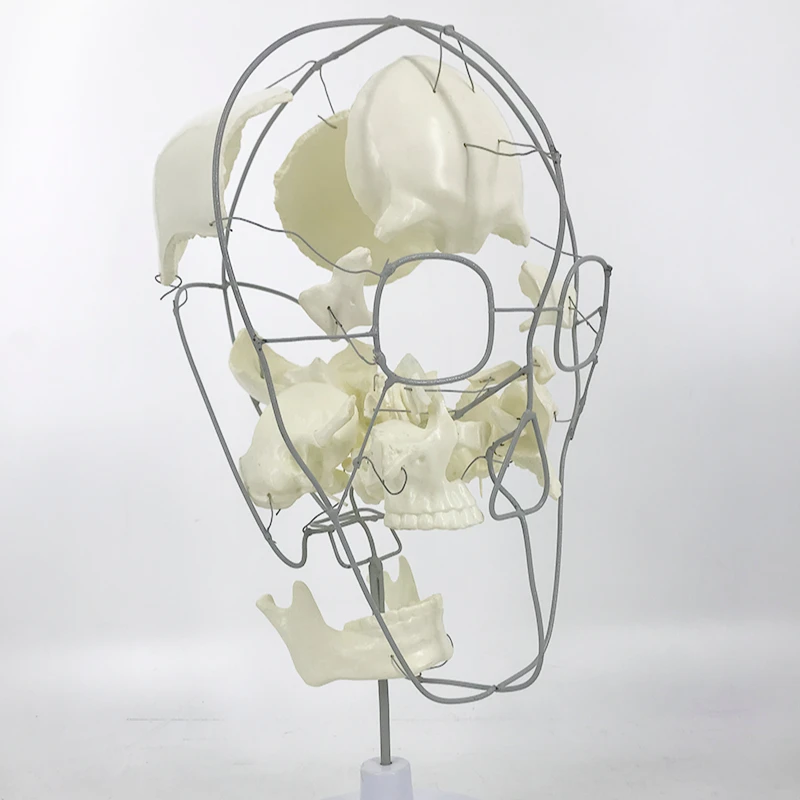 Череп человека с разделением остсов