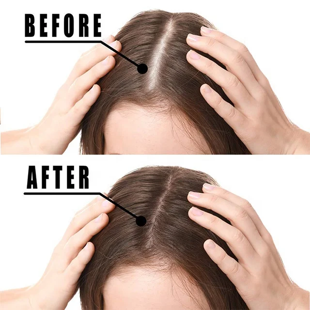 Natural Herbal Organic Private Label Custom hair Loss Care regrowth treatment products Hair Growth Oil