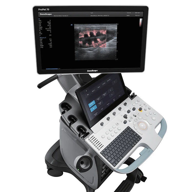 2023 New Arrival Sonoscape ProPet70 Veterinary Animal Trolley Color Ultrasound Machine