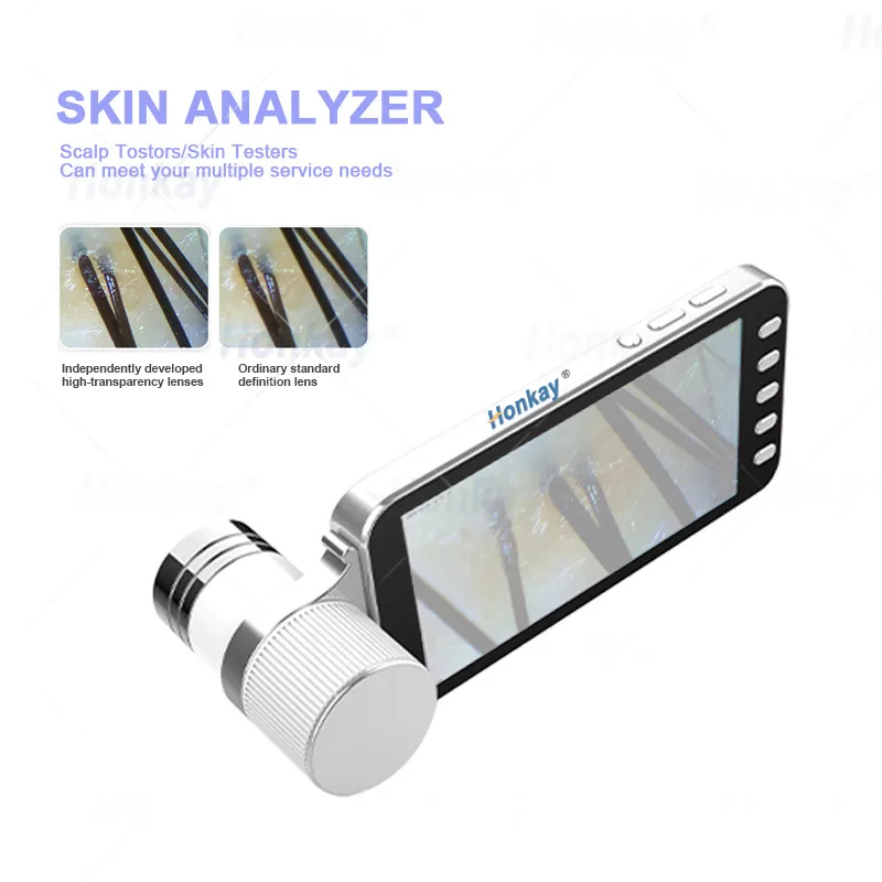Portable Scalp Detector 5.5 Inch Hd Scalp Detection 200x Skin Inspection 50x 16g Image Storage Hair Skin Analyzer