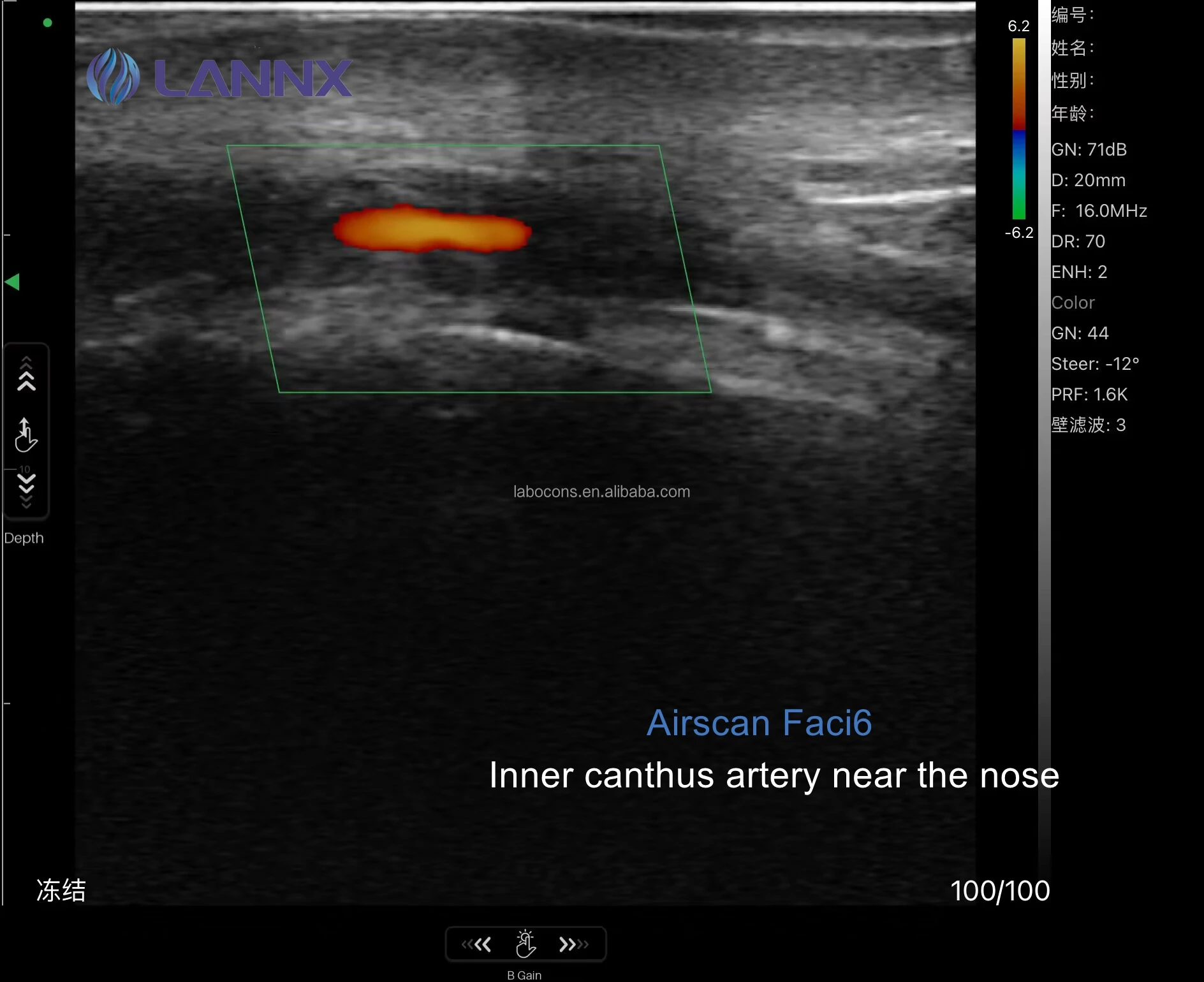 LANNX Airscan Faci6 In stock Color USG Scanner 3 in 1 ultrasound Probe for Mapping Injection Wireless Portable Probe Ultrasound